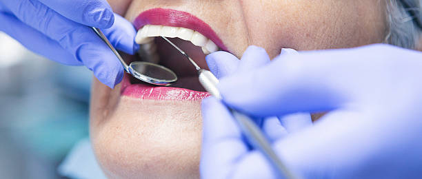 Best Emergency Dental Extractions in Morrice, MI